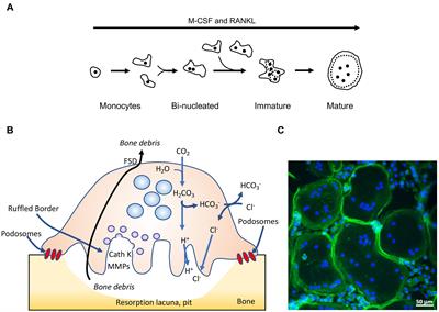 Sorting Nexin 10 as a Key Regulator of Membrane Trafficking in Bone-Resorbing Osteoclasts: Lessons Learned From Osteopetrosis